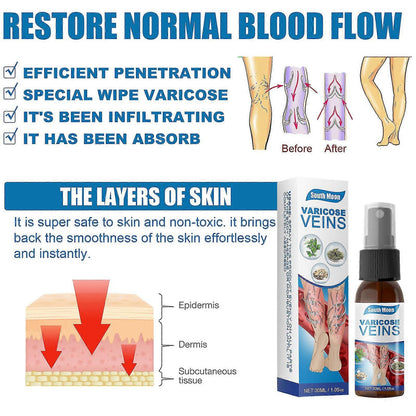 🔥HOT SALE 50% OFF🔥 Varicose Veins Relief Spray